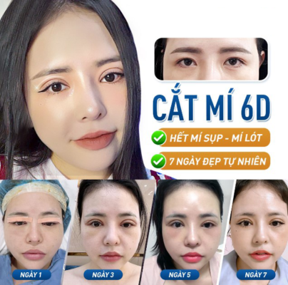 cat mi4